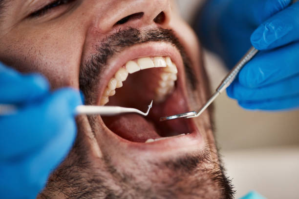 Best Cracked Tooth Emergency Dentist  in Glyndon, MN