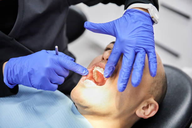 Best Root Canal Emergency Dentist  in Glyndon, MN